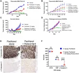 Oncotarget: Glucocorticoid receptor antagonism promotes apoptosis in solid tumor cells