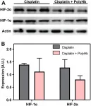 Oncotarget: Hemoglobin increases the effectiveness of chemotherapy in lung cancer