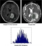 Oncotarget: HIV +/- patients with lymphoma as a predictor of outcome & tumor proliferation