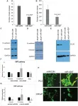 Oncotarget: MicroRNA-4287 is controlling epithelial-to mesenchymal transition in prostate cancer