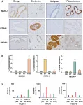 Oncotarget: Quantitative proteome profiling stratifies fibroepithelial lesions of the breast