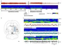 One-stop implementation from signal detection to processing 3