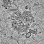 Oocytes outsmart toxic proteins to preserve long-term female fertility