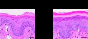 Oral barrier is similar in ceramide composition to skin barrier 2