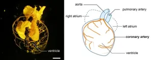 Origins of coronary arteries