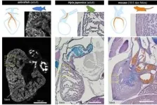 Origins of coronary arteries 2