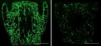 Osteoblasts are bone idle without Frizzled-9