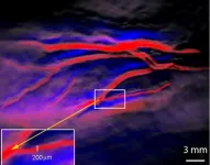 OU scientists tests revolutionary imaging technique for pancreatic cancer