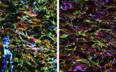 Over-organizing repair cells set the stage for fibrosis