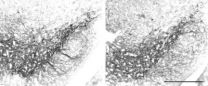 Parkinson's disease may be caused by microtubule, rather than mitochondrial complex I, dysfunction