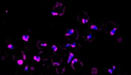 Peering inside cells to see how they respond to stress