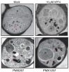 Penn team mimicking a natural defense against malaria to develop new treatments