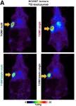 PET imaging validates use of common cholesterol drug to enhance HER2-targeted cancer therapy