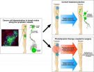 Photodynamic therapy against cancer