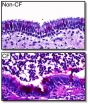 Pig model of cystic fibrosis improves understanding of disease