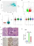 Potential new target for colorectal cancer treatment