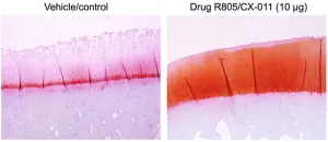 Potential relief for osteoarthritis moves to clinical trial after animal studies