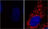 Potential treatment and prevention of Parkinsons disease