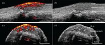 Powerful imaging for point-of-care diagnostics