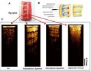 Precision-guided epidurals and better blood monitors