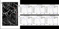 Precision-guided epidurals and better blood monitors 2