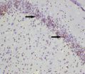 Pretreatment with SSTF prevents hippocampal neuronal apoptosis due to cerebral infarction