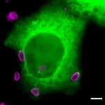 Preventing the break-in of the toxoplasmosis parasite