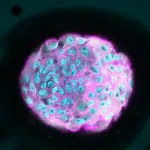 Preventing the tissues response to stiffness may be key to slowing the progression of breast tumors