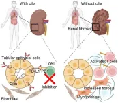 Primary cilia restrict autoinflammation by mediating PD-L1 expression