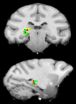 Princeton study reveals the brains mysterious switchboard operator