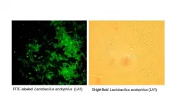 Probiotic Lactobacillus acidophilus shows promise for treating inflammatory bowel disease and other