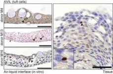 Producing tears in a dish: researchers develop first model of human conjunctiva 2