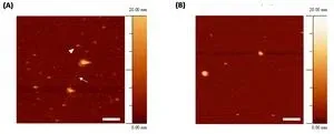 Promising ‘first’ in Alzheimer’s drug development 2