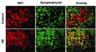 Promising new finding for therapies to  treat persistent seizures in epileptic patients