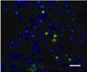 Protective effect of α-synuclein knockdown on dopaminergic neurons