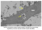 Protective proteins reduce damage to blood vessels