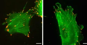 Protein's 'silent code' affects how cells move