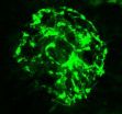 Proteins critical to wound healing identified 2