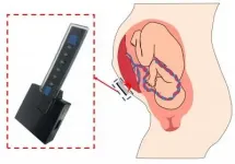 Prototype may diagnose common pregnancy complications by monitoring placental oxygen