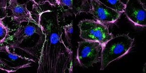 Pseudomonas aeruginosa Bacteria produce a molecule that paralyzes immune system cells