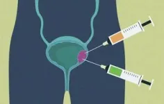 Putting a lid on excess cholesterol to halt bladder cancer cell growth 2