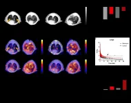 Radiotracer effective for detection and assessment of lung fibrosis