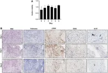 Real-time live tissue sensitivity assay for pancreatic adenocarcinoma