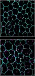 Recycling of the eyes light sensors is faulty in progressive blindness of older adults