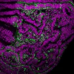 Relationship between chromosomal instability and senescence revealed in the fly Drosophila