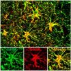 Rescue of Alzheimers memory deficit achieved by reducing excessive inhibition