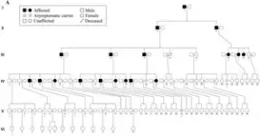 Research reveals novel CARS E795V mutation as cause of inherited Parkinson's disease 2