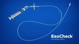 Researchers at Case Western Reserve, University Hospitals to begin clinical testing with new, less-invasive technology to screen for esophageal precancer 3