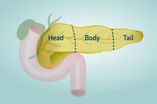 Researchers at Houston Methodist find difference in pancreatic cancer cells, offering new hope for immunotherapy effectiveness