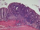 Researchers at IRB discover a key regulator of colon cancer 3